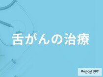「舌がんの治療」はどう進む？医師が手術・放射線・薬物療法の特徴や注意点を解説！