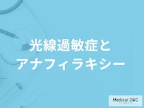 「光線過敏症はアナフィラキシー」を起こす可能性がある？症状と予防法も解説！