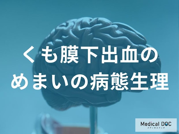 「くも膜下出血」と「めまい」の関係をご存じですか？ 脳幹・小脳への影響を医師が解説