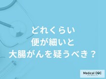 「どれくらい便が細いと大腸がん」を疑うべき？大腸がんを疑う便の特徴も医師が解説！