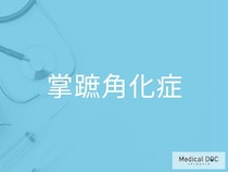 「掌蹠角化症」の初期症状をご存じですか？ 手のひら・足の裏が赤く厚くなる理由を医師が解説