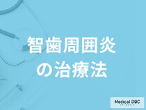 「智歯周囲炎の治療」で入院の可能性も？治療中の注意点や予防法を医師が解説！
