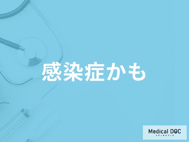 【インフルエンザ・コロナ】長引く咳の対処法はご存じですか? 予防法も医師が解説