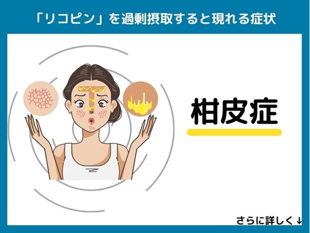 リコピンを過剰摂取すると現れる症状