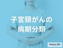 子宮頸がんのステージ（病期）分類とは？I〜IV期の特徴とMRI・CTなどの画像診断