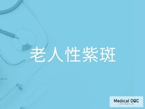 「老人性紫斑」ができやすい人の特徴とは 加齢・紫外線・皮膚の薄さとの関係を医師が解説