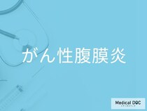 「がん性腹膜炎」の初期症状をご存じですか？ 再発チェックと早期発見の重要性を医師が解説