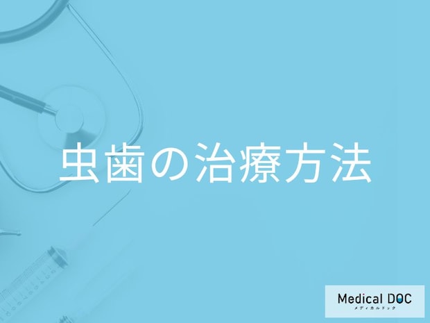 「むし歯の治療法」はご存じですか？軽度から抜歯まで歯科医師が解説！
