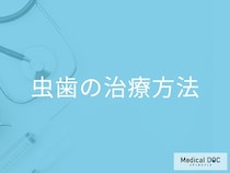 「むし歯の治療法」はご存じですか？軽度から抜歯まで歯科医師が解説！
