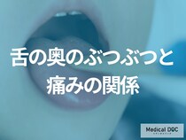 やけど？感染症？「舌の奥にぶつぶつ」ができるのは？痛みあり・なし別に歯科医師が解説！