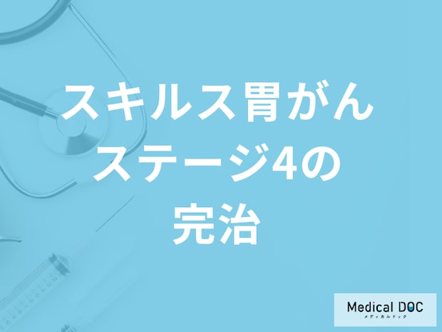 「スキルス胃がんのステージ4でも完治」は可能なのか?4つの治療法も医師が解説!