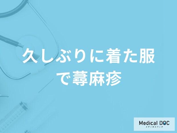 「久しぶりに着た服で蕁麻疹」になる原因はアレルギー？対処法も医師が解説！