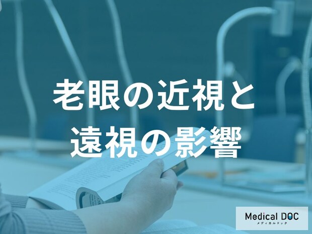 30代から始まる人も。遠視の老眼は進行が早い傾向あり！近視との違いと正しい矯正法