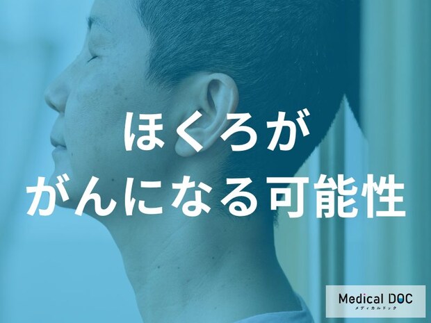 ほくろががんになる確率は？悪性化のリスク因子と早期発見のためのABCDEルール