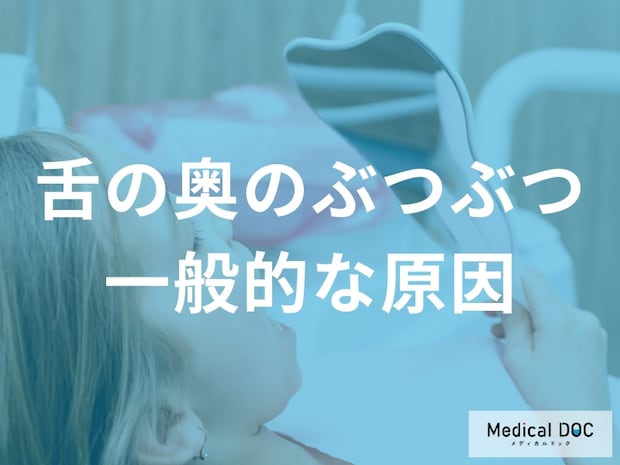 「舌の奥にぶつぶつ」は”性感染症”のサイン？何科に受診すれば良いかも歯科医師が解説！