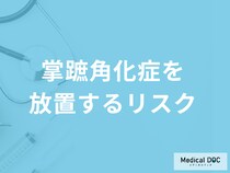 「掌蹠角化症を放置すると起こるリスク」はご存じですか？注意点も医師が解説！