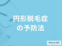 「円形脱毛症を予防」するには毎日何をすれば良いかご存じですか？医師が解説！