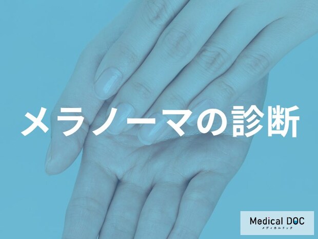 日本人は足の裏や爪に多い！増加傾向のメラノーマの特徴と、確定診断までの流れ