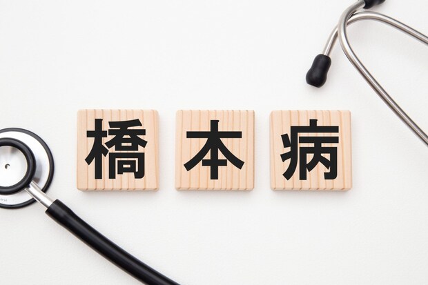 橋本病とは？ 女性に多い理由と特徴