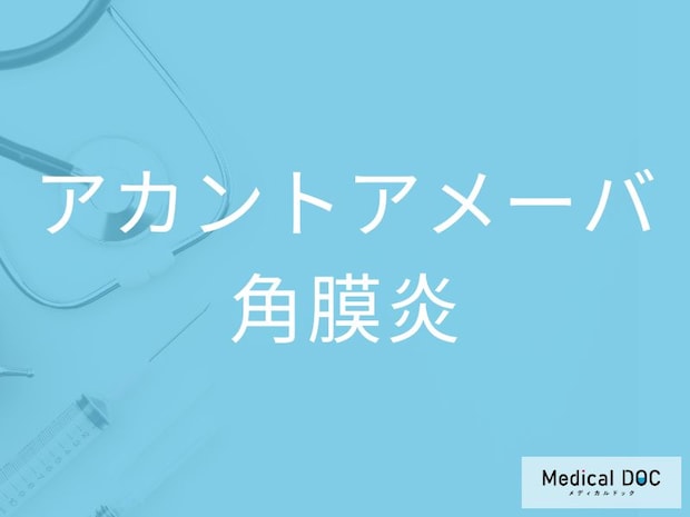 コンタクトレンズ使用者は知っておきたい！ 「アカントアメーバ角膜炎」の初期症状を医師が解説