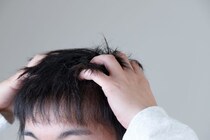 ミノキシジルの副作用とは？効果や外用薬と内服薬の違いについて解説