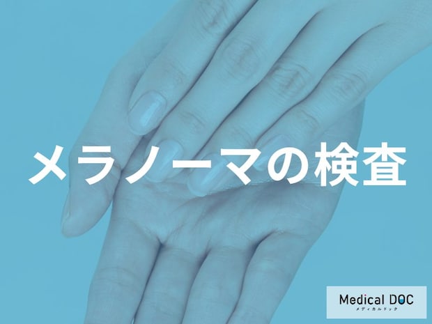 メラノーマと診断されたら？転移を確認するCTやPET検査、センチネルリンパ節生検