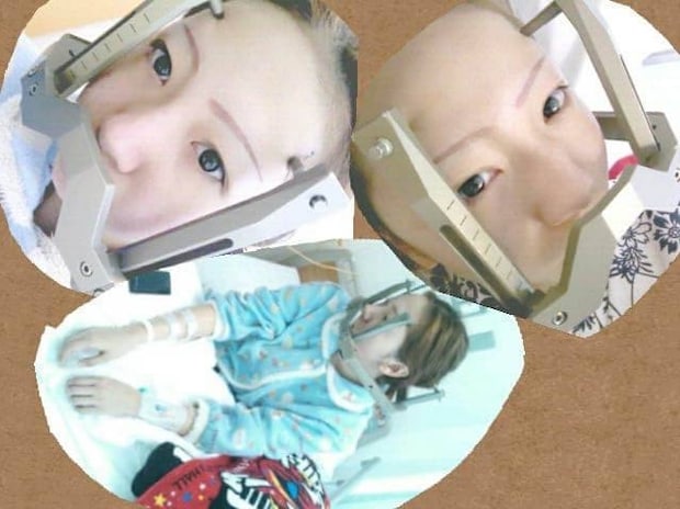 【闘病】頭痛きっかけで『脳の血管に異常』が発覚 「てんかん発作」も起きるように…