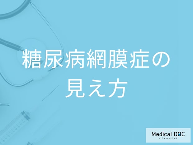 「糖尿病網膜症」を発症するとどんな見え方になるかご存知ですか?【医師監修】