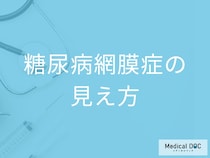 「糖尿病網膜症」を発症するとどんな見え方になるかご存知ですか？【医師監修】