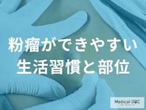 粉瘤の原因は摩擦だった？できやすい部位と日常生活で気をつけたいこと