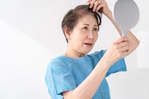 女性の「薄毛治療」を医師が解説 男性のAGAと違うの？ 植毛も男性だけのものではない