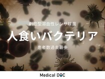 【人食いバクテリア】致死率30％の劇症型溶血性レンサ球菌感染症 患者数が過去最多に
