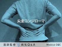 「尖圭コンジローマ」とは？男女別の症状・原因についても解説！【医師監修】