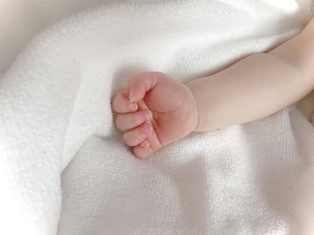 アッシャー症候群