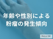 粉瘤はなぜ男性に多い？20代〜40代に多く見られる発症傾向を医師が解説