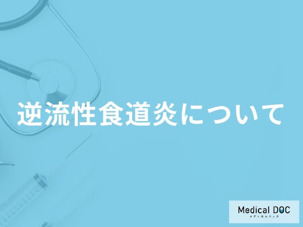「逆流性食道炎」を発症すると現れる3つの症状はご存知ですか?原因についても解説!