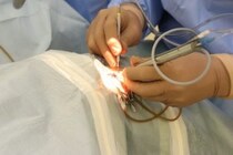 日帰り白内障手術に密着してみた Vol.1 カウンセリング編