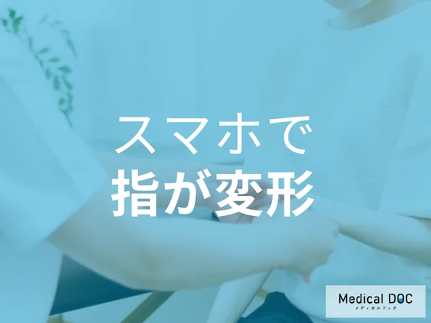 スマホの重みで小指が変形… 痛みやしびれが「関節症」の始まりかも【医師解説】