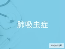 “結核”や“肺がん”と似た症状に注意！ 「肺吸虫症」の見分け方を医師が解説