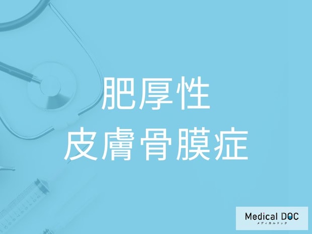 「肥厚性皮膚骨膜症」の初期症状をご存じですか？ 10代から現れる皮膚と骨の変化を医師に聞く