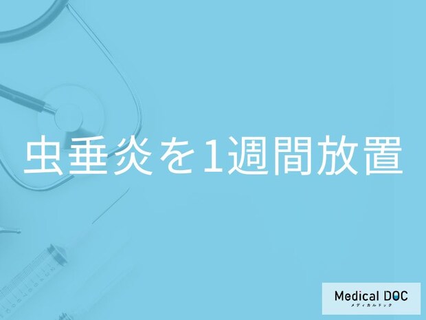 「虫垂炎を1週間放置」するとどうなるかご存知ですか？現れる症状も解説！