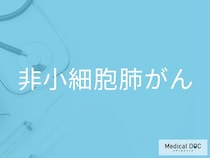 「非小細胞肺がん」の初期症状を見落とさないために 咳・血痰・息切れが続く場合は要検査？【医師監修】
