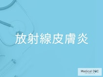 放射線治療後に皮膚が赤くなる？ 「放射線皮膚炎」の特徴と注意点を医師が解説