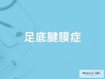 「足底腱膜症」の症状・原因・なりやすい人の特徴はご存知ですか？【医師監修】