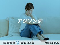 「アジソン病」とは？症状・原因・治療法についても解説！【医師監修】