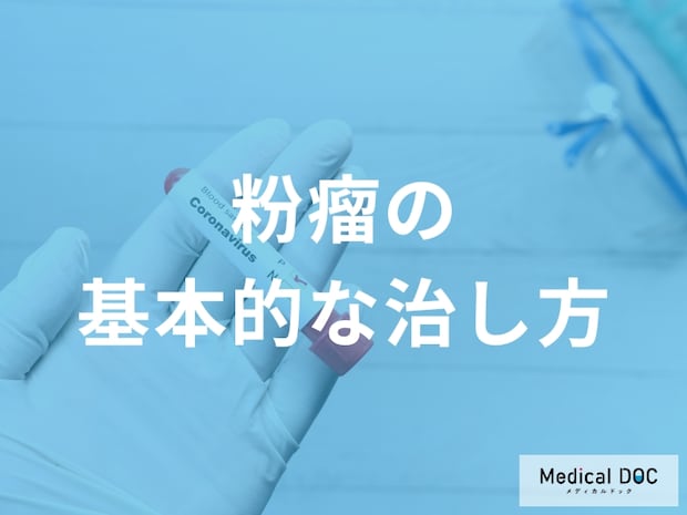 粉瘤を根本から治す　手術で「袋ごと取る」ことの重要性と治療の選択肢