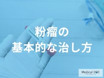 粉瘤を根本から治す　手術で「袋ごと取る」ことの重要性と治療の選択肢