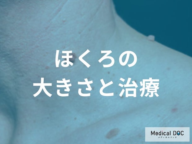 6mm超は要注意！ほくろ切除の種類と選び方｜悪性を見逃さない検査とは
