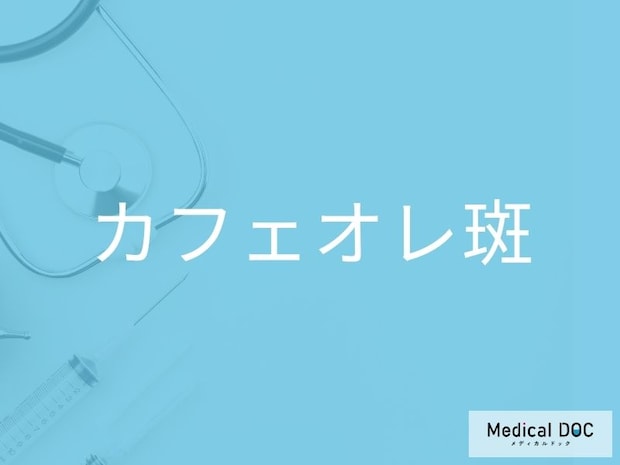 “皮膚の茶色いあざ”の原因はご存じですか？ 「カフェオレ斑」の特徴と注意点を医師が解説