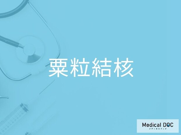 命に関わることもある「粟粒結核」 早期発見・早期治療が重要な理由を医師に聞く